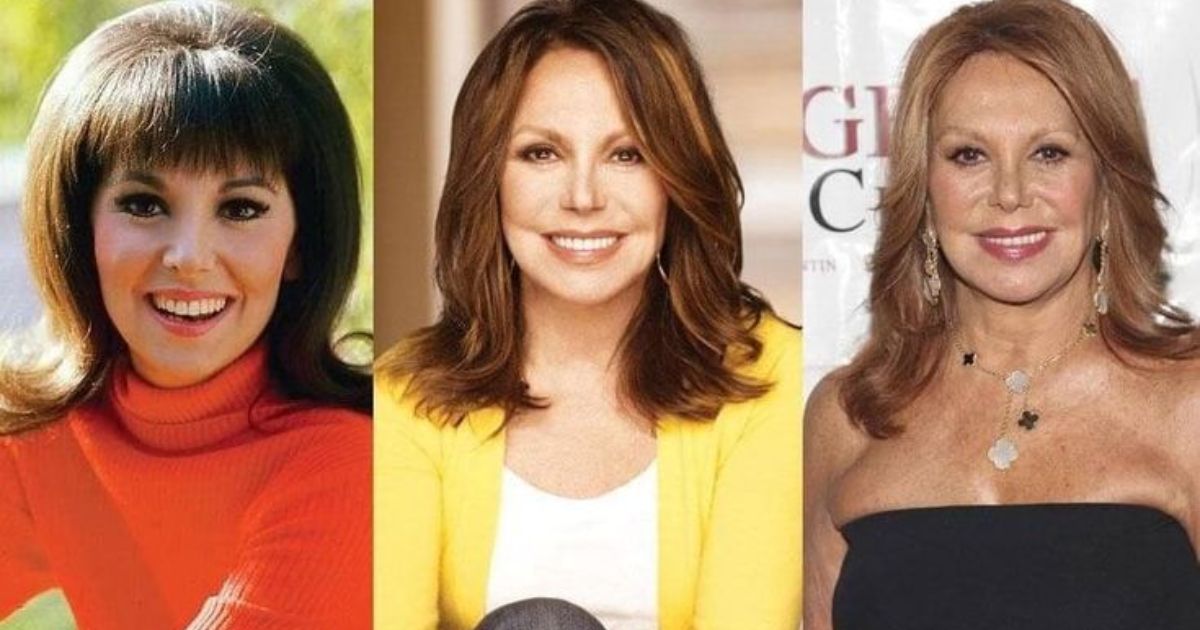 The Transformation of Marlo Thomas’s Face