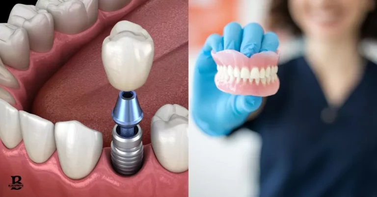 $399 Dental Implants